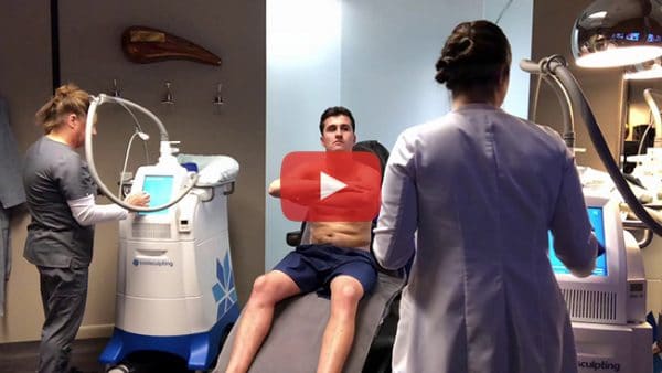 coolsulpting treatment